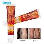 Sumifun Varicose Veins Cream – Promote Blood Circulation & Relieve Pain